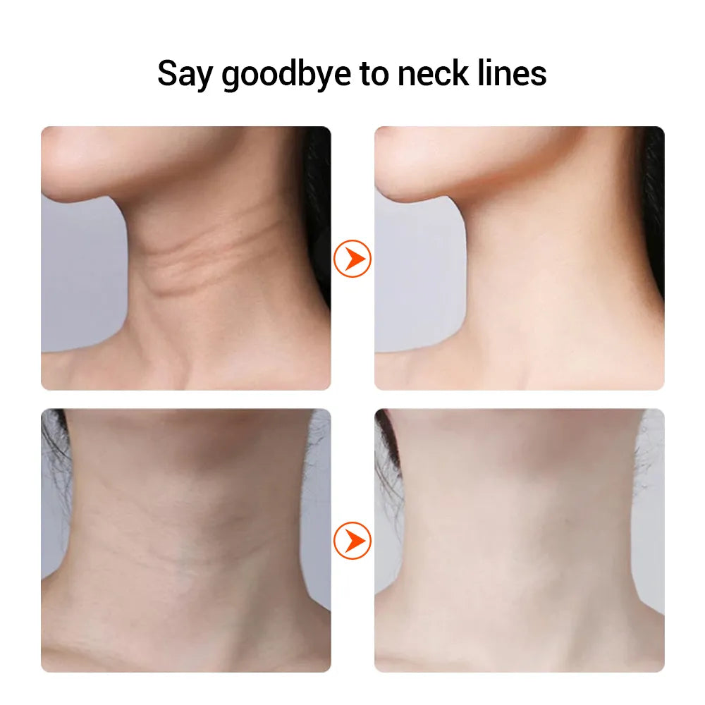 EMS Anti-Wrinkle Face and Neck Massager